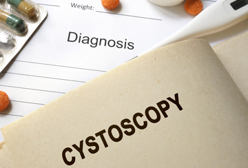 CMS Publishes New Payment Rates for Blue-light Cystoscopy
