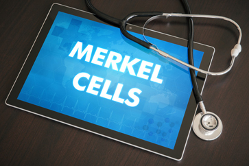 ICD-10 Codes to Document Merkel Cell Carcinoma
